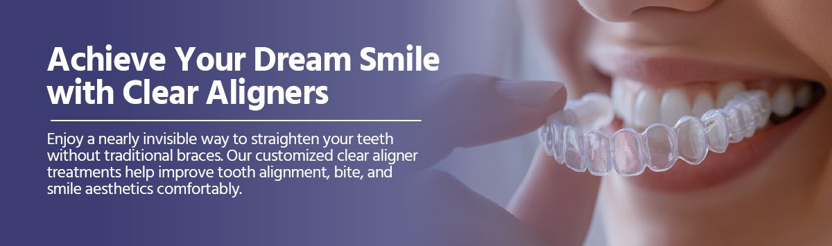aligners-home-banner-mi-min